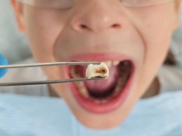 Best Pediatric Emergency Dentist in Kensington, CA